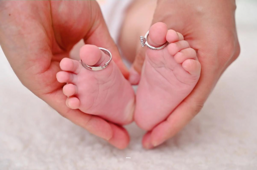 黄山孕妇怎样预防妊娠纹